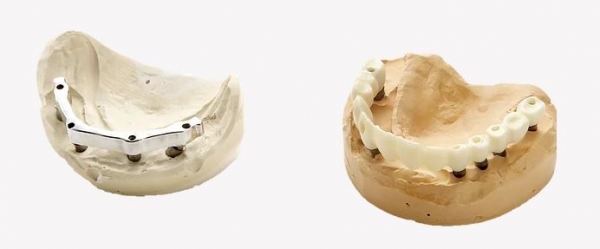 CAD-CAM | TDA Dental